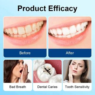 Giải pháp chăm sóc răng miệng cao cấp, nguồn cung cấp đáng tin cậy cho việc chăm sóc nướu, Răng Trăng Đánh Bay Sâu Răng