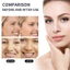 【Roshy】Mặt nạ collagen sinh học làm săn chắc da dưỡng ẩm làm sáng da chống nếp nhăn mặt nạ dưỡng da