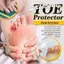 Silicone Ngón Tay Mũi Nắp Bảo Vệ Bao Tay Cái Ngô Vỉ Giảm Đau Ngón Chân Ống Bunion Chỉnh Chăm Sóc Bàn Chân