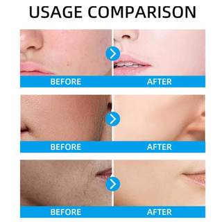 Vitamin C Facial Essense Serum with Hyaluronic Acid 30ml