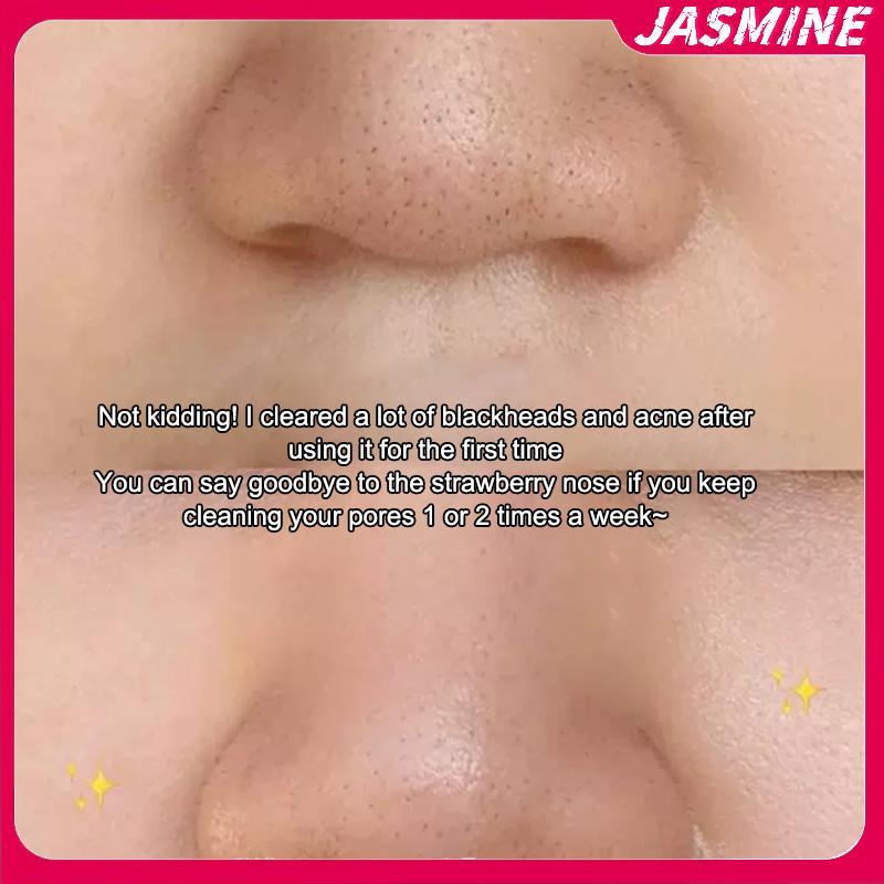 JASMINE Facial Skin Scrubber head Remover Có Nắp Mặt Thìa Tẩy Tế Bào Chết Làm Sạch Sâu Dụng Cụ Chăm Sóc Da JASMINE