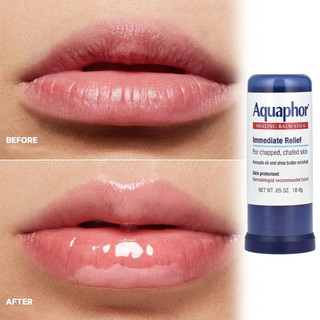Aquaphor Healing Balm Stick, Skin Protectant with Avocado Oil and Shea Butter