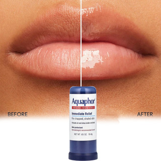 Aquaphor Healing Balm Stick, Skin Protectant with Avocado Oil and Shea Butter