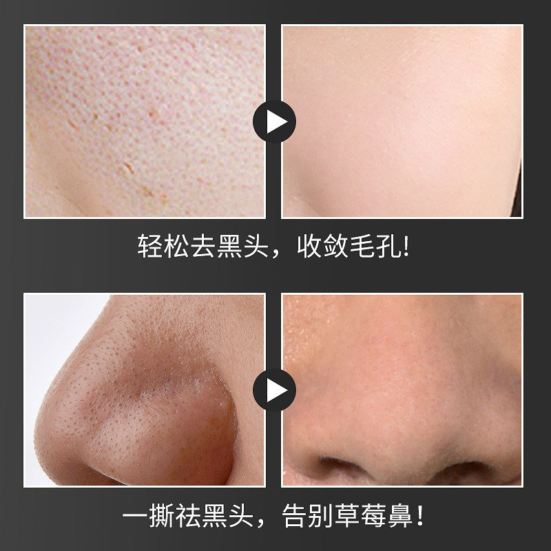 Kem dưỡng mặt nạ mụn đầu đen Loại bỏ sự ổn định Loại bỏ mụn đầu đen Mặt nạ lột lỗ chân lông mịn Mặt nạ mũi 25.11.7