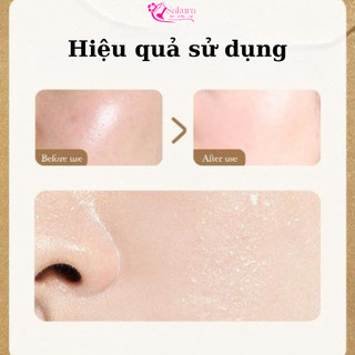 Tinh Chất Bột Đông Khô Dưỡng Ẩm, Chăm Sóc Da Mặt Làm Sáng Da, Mềm Mại, Tăng Độ Đàn Hồi, Chống Lão Hóa....