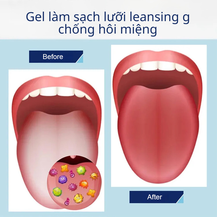 Kem làm sạch lưỡi/Gel phủ lưỡi Probiotic / Làm sạch lưỡi / Kem phủ lưỡi hơi thở thơm mát / Kem phủ lưỡi hôi miệng