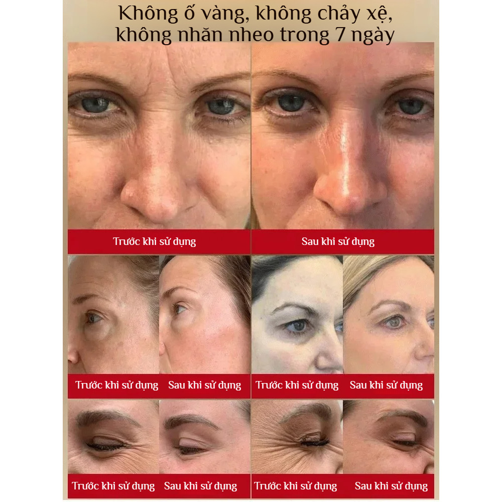 🔥Giá sốc🔥Kem chống nhăn mặt, kem dưỡng ẩm và cấp nước cho mặt, kem giảm nhăn và săn chắc da mặt、kem dưỡng ẩm