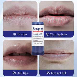 Aquaphor Healing Balm Stick, Skin Protectant with Avocado Oil and Shea Butter