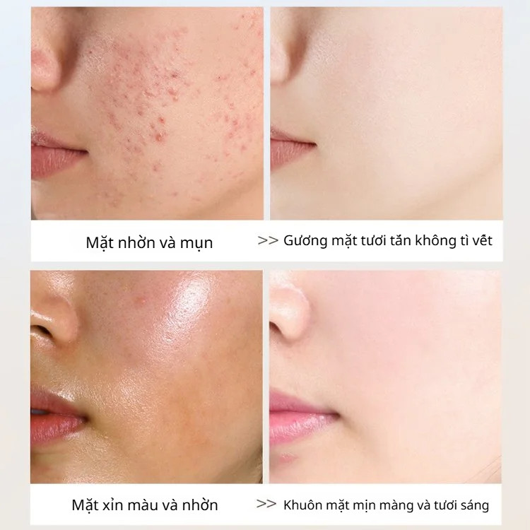 Sữa rửa mặt dưỡng ẩm và cấp nước Sữa rửa mặt làm trắng nhẹ nhàng Sữa rửa mặt kiểm soát dầu và loại bỏ mụn đầu đen