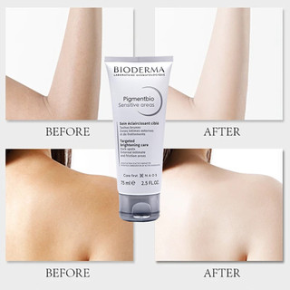 BIODERMA Pigmentbio Sensitive Areas Targeted 75 ml body Skin Brightening