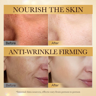 Bee Venom Chống Nhăn Làm Săn Chắc Serum Nuôi Dưỡng Dưỡng Ẩm Trẻ Hóa Da Mặt 50ml