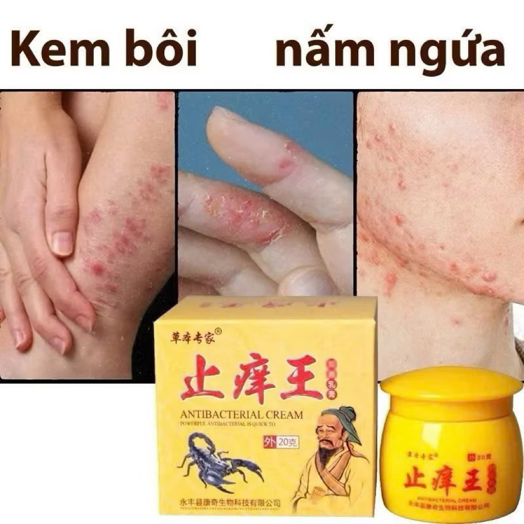 Hũ Kem Vua Bọ Cạp Vàng: Dứt Điểm Nấm Ngứa, Tổ đỉa, Á Sừng, Nấm Móng Tay Chân, Kem Bôi ông Lão - Cực Hiệu Quả