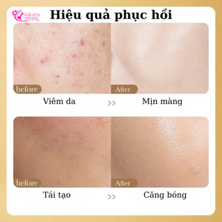Tinh Chất Bột Đông Khô Dưỡng Ẩm, Chăm Sóc Da Mặt Làm Sáng Da, Mềm Mại, Tăng Độ Đàn Hồi, Chống Lão Hóa....