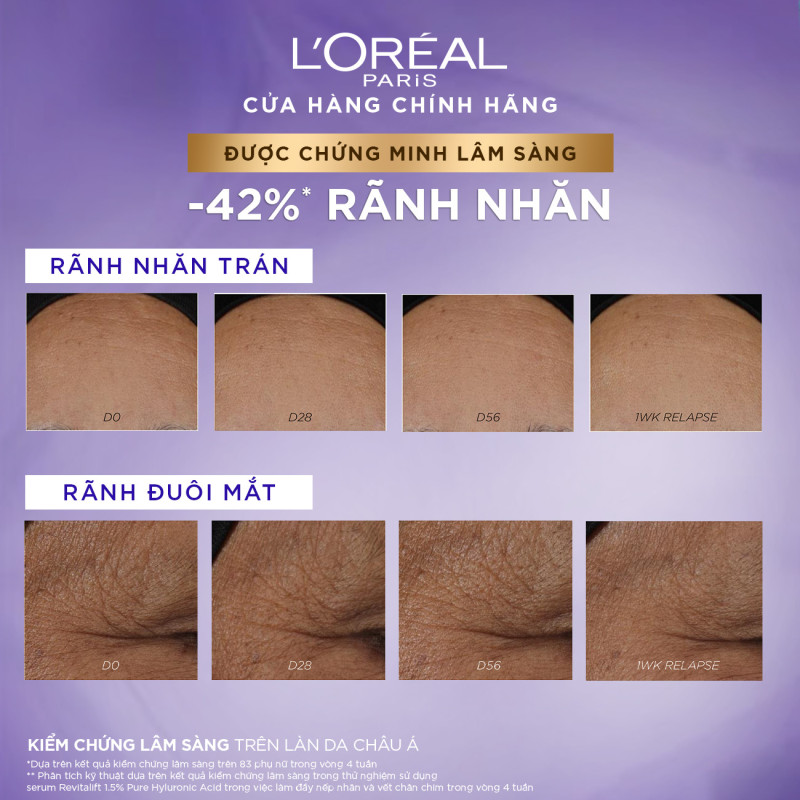 [QUÀ TẶNG KHÔNG BÁN] Kem dưỡng ban đêm chống lão hóa sớm Revitalift HA Line Plumping Dream Cream L'Oréal Paris 15ml