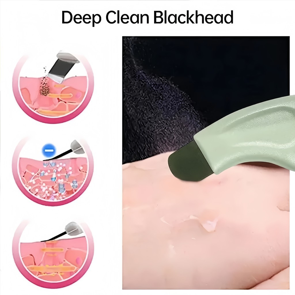 Loại bỏ mụn đầu đen Da chết Acne Silicone Scraper Facial Hair Follicle Cleaner là một công cụ làm đẹp cho thẩm - FE123