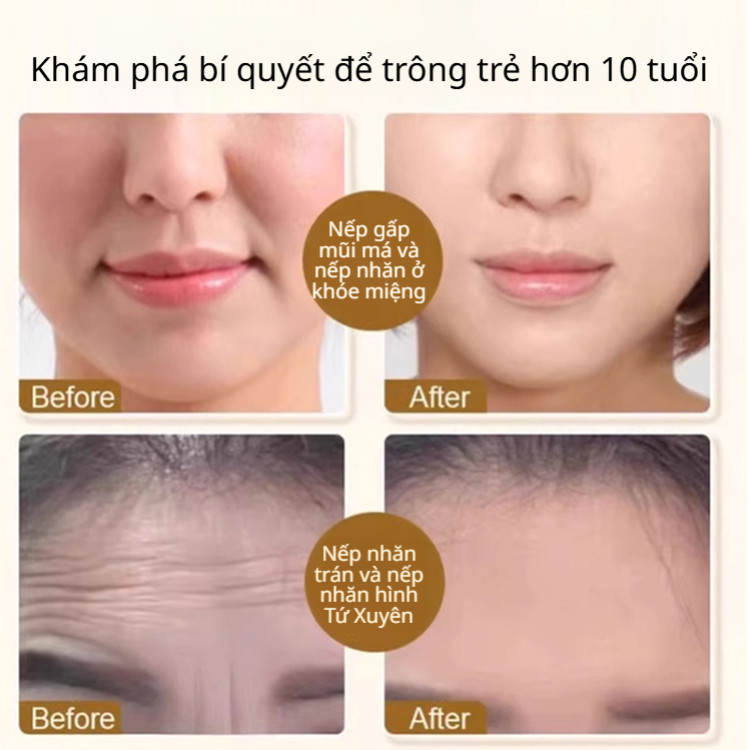 🔥Giá sốc🔥Băng dán cơ nâng cơ mặt / Băng dán mặt / Băng dán cơ nâng cơ da cho nếp nhăn mũi má và trán/Miếng dán giảm nếp nhăn và nâng cơ / Miếng dán giảm nếp nhăn có thể điều chỉnh độ co giãn cao