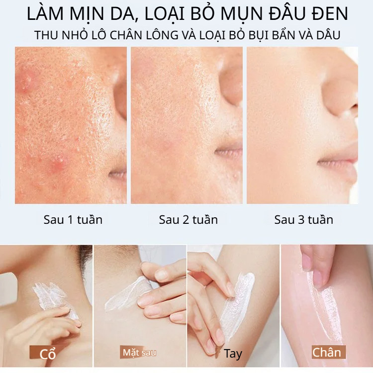 Sữa rửa mặt dưỡng ẩm và cấp nước Sữa rửa mặt làm trắng nhẹ nhàng Sữa rửa mặt kiểm soát dầu và loại bỏ mụn đầu đen