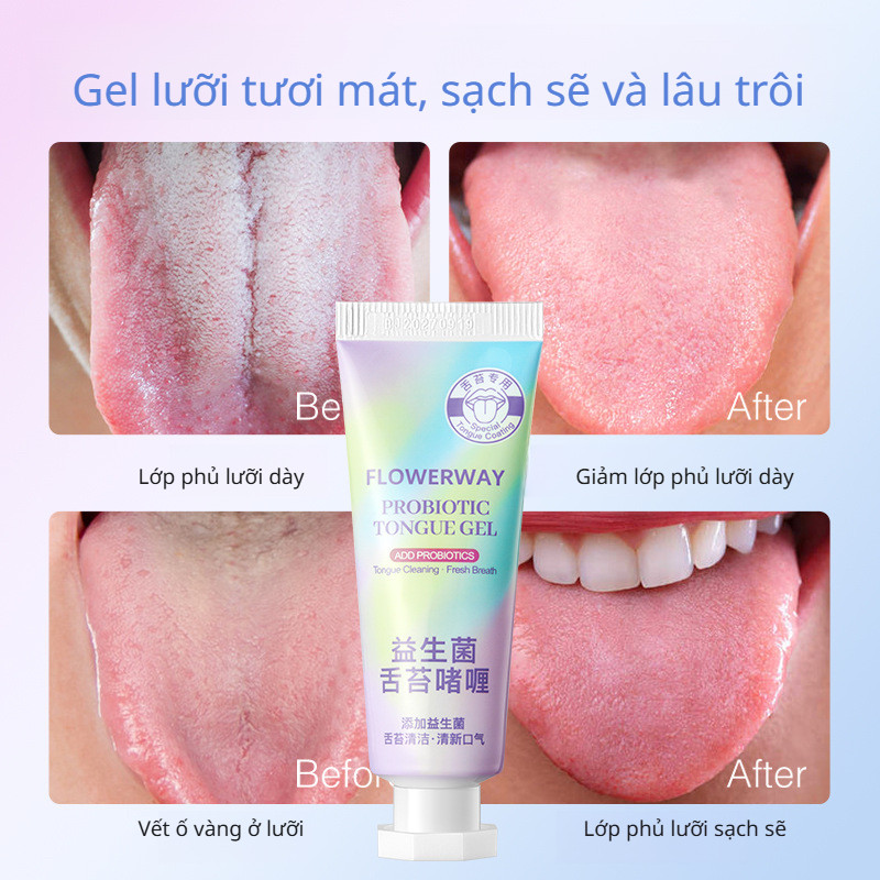 Kem làm sạch lưỡi/Gel phủ lưỡi Probiotic / Làm sạch lưỡi / Kem phủ lưỡi hơi thở thơm mát / Kem phủ lưỡi hôi miệng