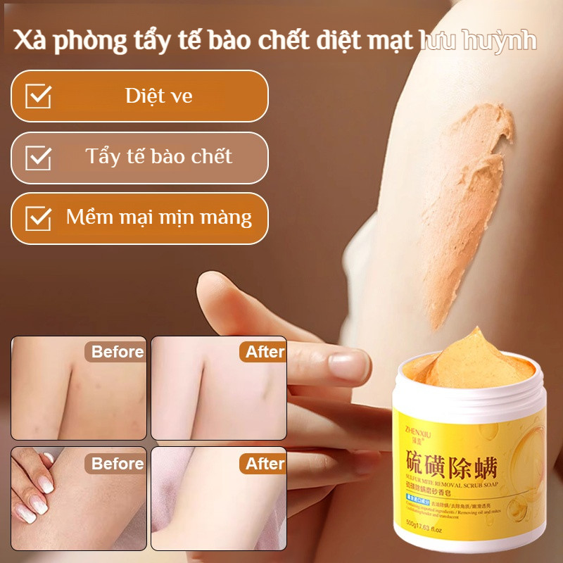 Xà Phòng Lưu Huỳnh Tẩy Da Chết Dịu Nhẹ Dưỡng Ẩm - Hình Ảnh Thực Tế