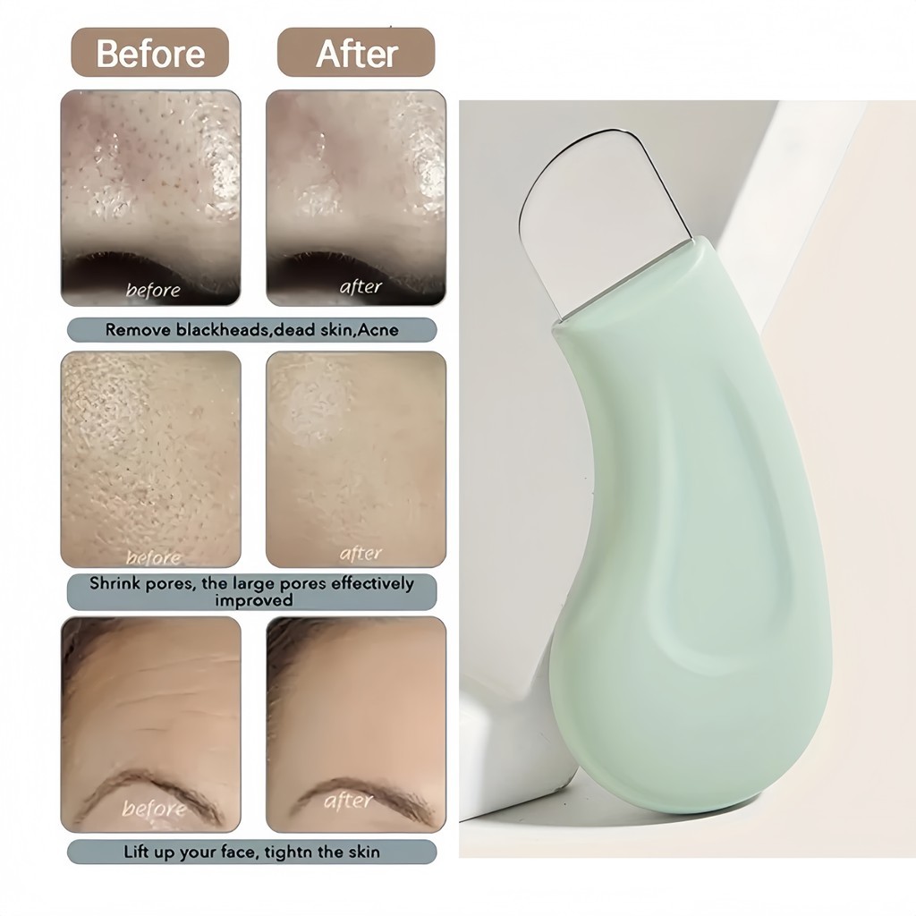 Loại bỏ mụn đầu đen Da chết Acne Silicone Scraper Facial Hair Follicle Cleaner là một công cụ làm đẹp cho thẩm - FE123