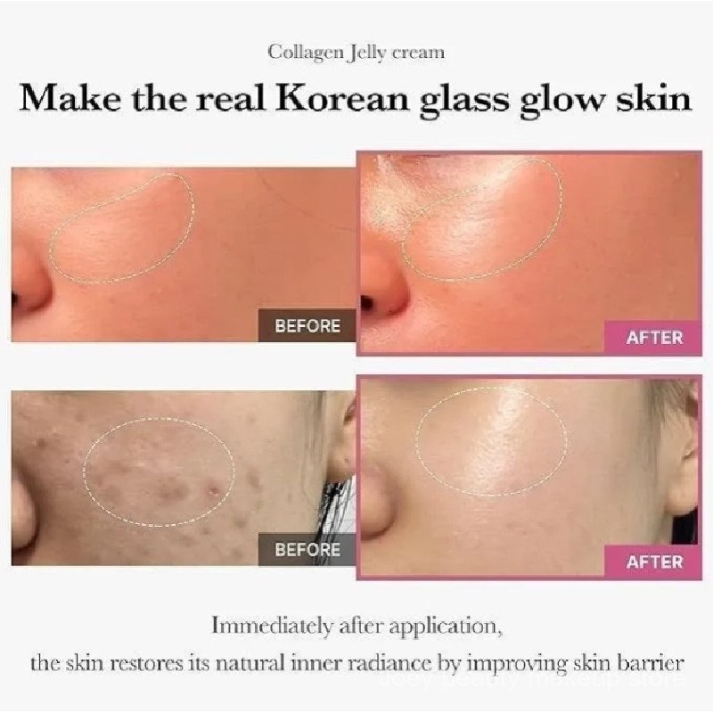 Kem dưỡng ẩm Medicube Collagen Elastic Jelly Cream 110ML VVZ5
