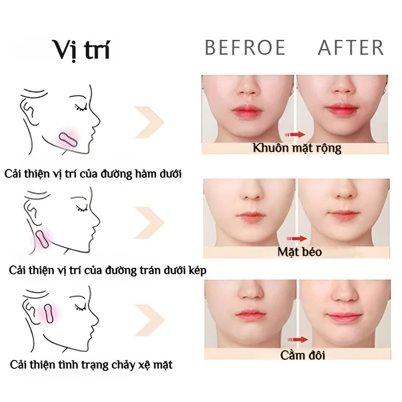 🔥Giá sốc🔥Miếng dán nâng cơ mặt/Miếng dán trang điểm làm thon gọn mặt/Băng dán mặt trong suốt vô hình/Miếng dán mũi cosplay/miếng dán mặt nâng cơ
