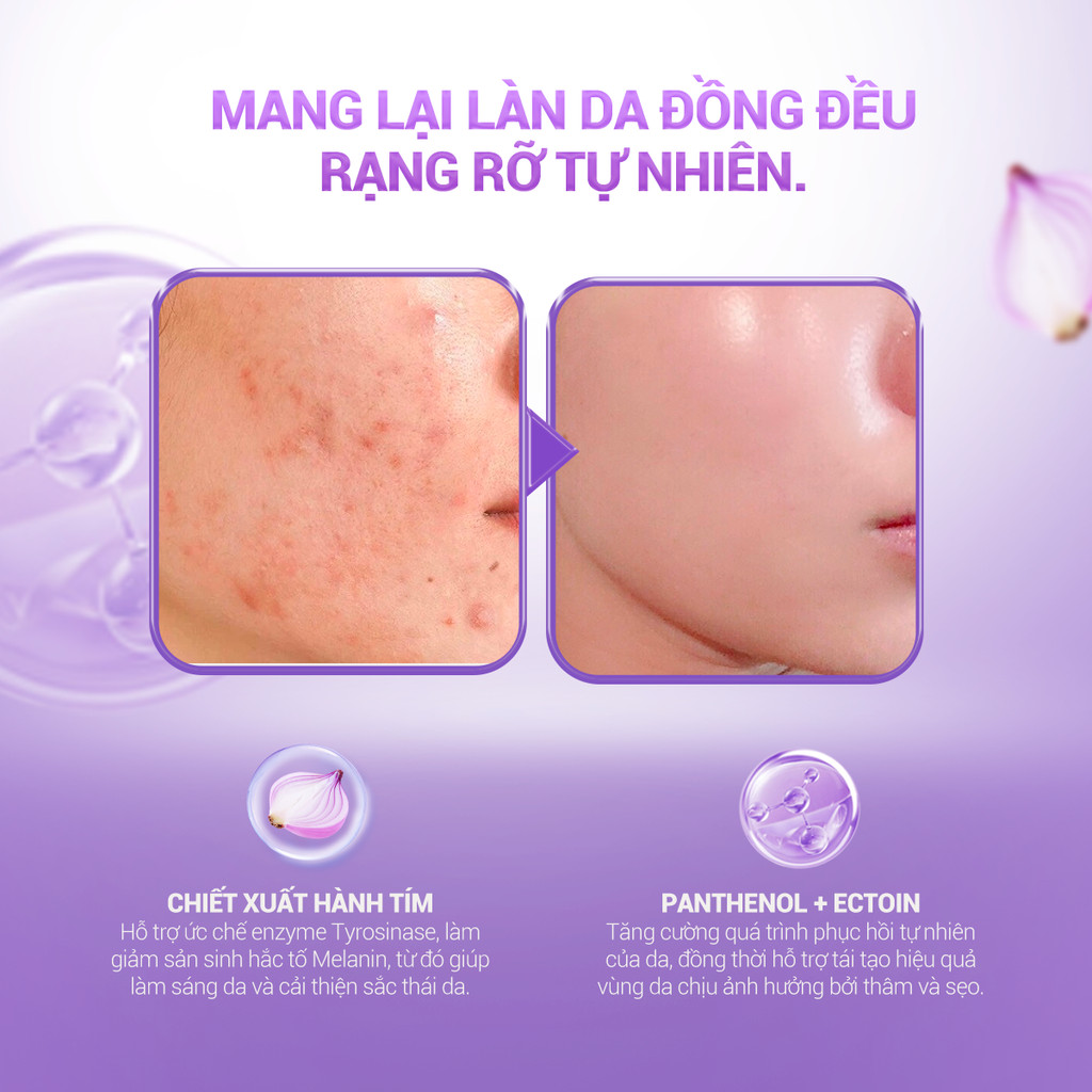 Miếng Mặt Nạ Hành Tím Botanic Fiber KEYSHU Dưỡng Ẩm, Hỗ Trợ Mờ Sẹo, Vết Thâm 1 Miếng 30ML