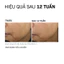 Kem Dưỡng Trẻ Hóa Màng Đáy Và Nâng Cấp Chất Lượng Da Toàn Diện REVISION SKINCARE D·E·J Face Cream 48g