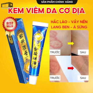 kem bôi nấm ngứa,kem bôi nấm ngứa trung quốc， viêm da cơ địa, vẩy nến, á sừng lang ben, hắc lào - thảo dược tự nhiên，