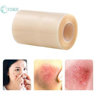 Chenlongshang Hydrocolloid Cuộn để chăm sóc vết thương Băng dán Hydrocolloid có khả năng tự dính, băng vết loét giường, thấm hút cao EN