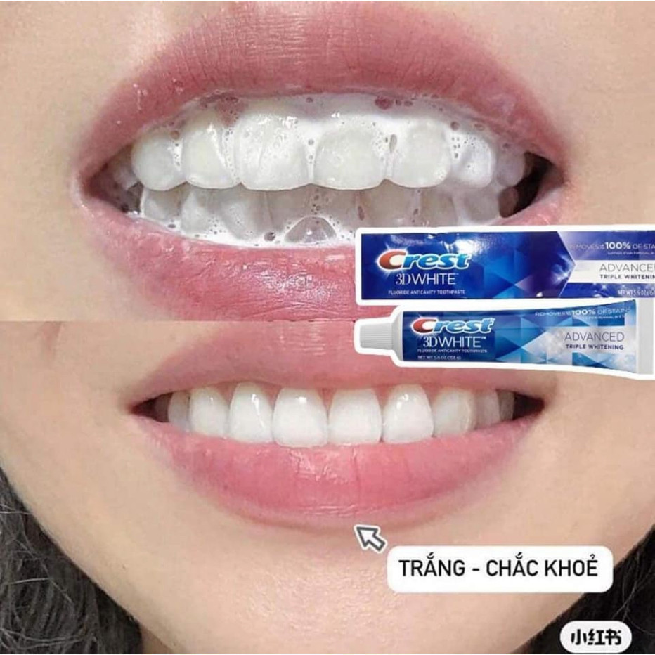 Kem Đánh Răng Crest 3D White Advanced Triple Whitening 147g - Làm Trắng Gấp Ba, Chống Ố Vàng & Bảo Vệ Men Răng