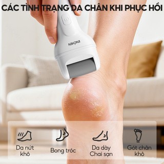 Máy Chà Gót Chân Enchen Rock 2 - 2 chế độ - mịn màng, chăm sóc gót chân | Bảo hành 12 tháng