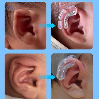 ELBBKG Hỗ Trợ Tai Xước Cho Trẻ Sơ Sinh Corrector Dụng Cụ Silicon Auricle Chỉnh Miếng Dán Cho Bé Tai Corrector Bé Auraille Valgus Chỉnh Mới
