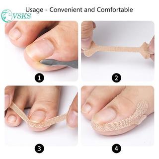Chenlongshang 8 / 20 Miếng Dán Chỉnh Sửa Móng Tay Cây Trồng Móng Chân Corrector Miếng Dán Paronychia Điều Trị Phục Hồi Corrector Dụng Cụ Làm Móng Chân EN