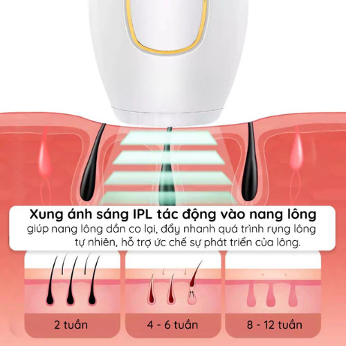 Máy triệt lông mini 5 cấp độ ánh sáng công nghệ IPL, hỗ trợ loại bỏ lông hiệu quả và an toàn tại nhà