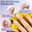 Mới Sửa Chữa Móng Tay Serum Bút Kem Làm Mềm Da Chết Nuôi Dưỡng Móng Tay