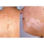 Kem bôi lang beng, hắc lào, giảm ban đỏ, nấm da đầu Fango-B Cream 15gr Siêu Hiệu Quả
