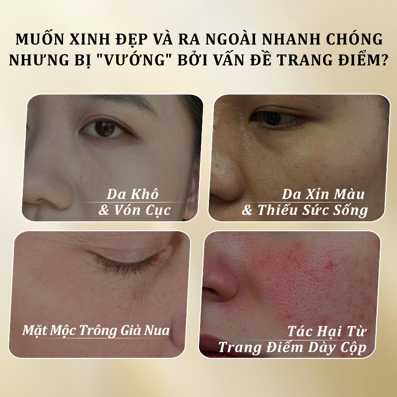 WithUpure Kem Dưỡng ẩm Làm Sáng Da 50g, Làm Sáng Da Nhẹ Nhàng Dưỡng Da Cao Cấp