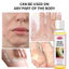DẦU PEELING CHIẾN LƯỢC CHIẾN LƯỢC ĐA NĂNG