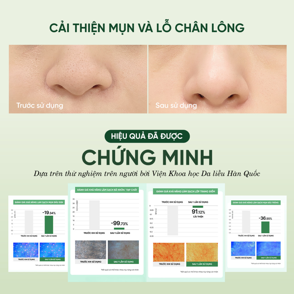 Mặt Nạ Rửa Mặt 2 In 1 Làm Sạch Sâu Cho Da Dầu Mụn Nhạy Cảm Dewdap Cicatea Pore & Sebum Pack Cleanser 150ml | BigBuy360 - bigbuy360.vn