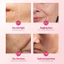 Polypeptide MicroneedleEssence