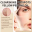 DẦU PEELING CHIẾN LƯỢC CHIẾN LƯỢC ĐA NĂNG