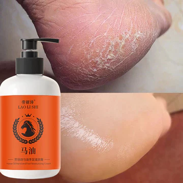 ⭐CHÍNH HÃNG⭐ Kem nứt gót chân kem bôi nứt gót chân Kem Dưỡng Ẩm Chống Nứt Nẻ Gót Chân 300g Chống Nẻ Da Tay Chân