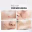 Tẩy Tế Bào Chết MD CARE AntiAc Exfo Kiểm Soát Mụn, Giảm Viêm Và Giảm Tiết Dầu