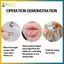 Dụng cụ cạo lưỡi chữ U bằng thép không gỉ BVY Loại bỏ chuyên nghiệp Dụng cụ chăm sóc vệ sinh răng miệng hôi miệng.