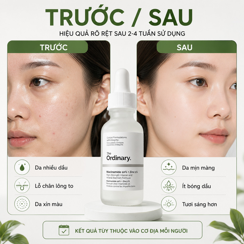 The Ordinary Niacinamide 10% + Zinc 1% 30ml Chính Hãng | Serum B3 Kiểm Dầu Mịn Da