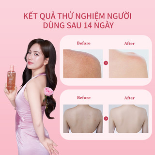 Bộ Kem Nách Và Sữa Tắm Cánh Hoa UILICY 30g+300ml Làm Sáng Vùng Nách, Đều Màu Da, Giảm Thâm Sạm, Làm Sạch Da Dịu Nhẹ