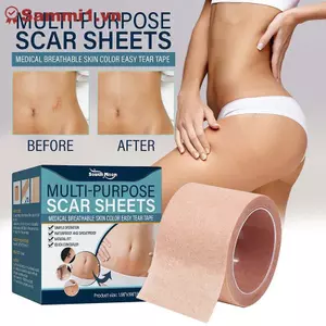 Miếng dán hình xăm che khuyết điểm ZK Che khuyết điểm Scar Birthmark Patch Tape (60-100 chiếc) VN