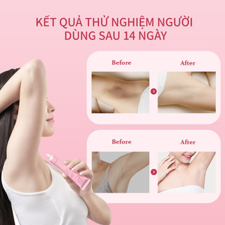 Bộ Kem Nách Và Sữa Tắm Cánh Hoa UILICY 30g+300ml Làm Sáng Vùng Nách, Đều Màu Da, Giảm Thâm Sạm, Làm Sạch Da Dịu Nhẹ