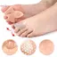 Dụng Cụ Tách Ngón Chân 2 Chiếc Bác Sĩ Lựa Chọn Đau Bunion Plantar Fasciitis Relief Soft Gel Cho Dailyfort Trong Giày